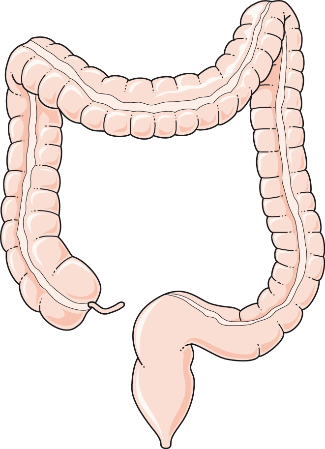 sintomas do câncer colorretal e anatomia do cólon e do reto no intestino grosso